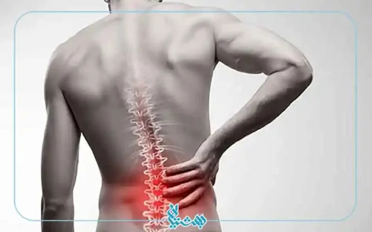 کمردرد از دید هاریسون